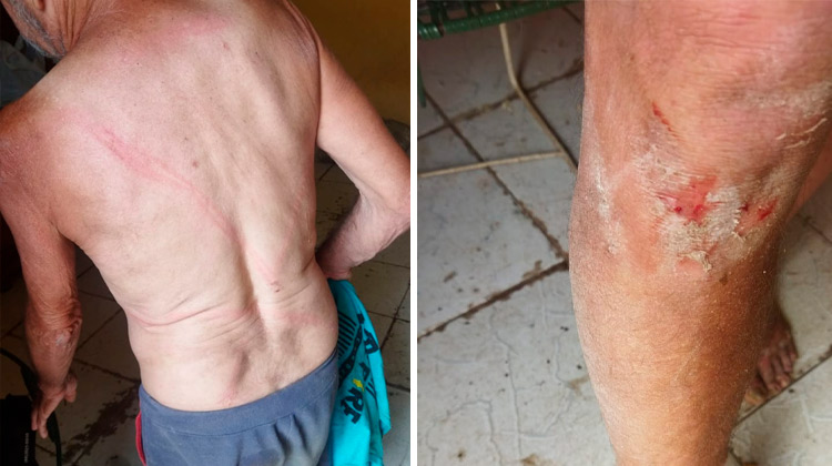 Filho agride o pai de 66 anos com barra de ferro em Juazeiro meses após ameaçar a mãe